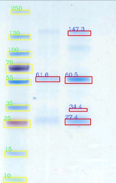 Gelapp: DNA&Prot Gel Analyzer