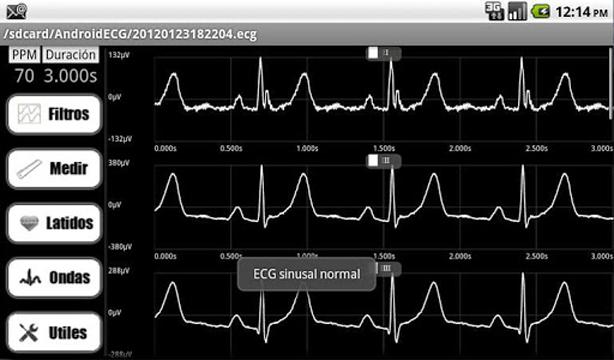 AndroidECG