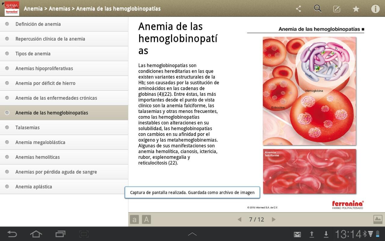 Anemia