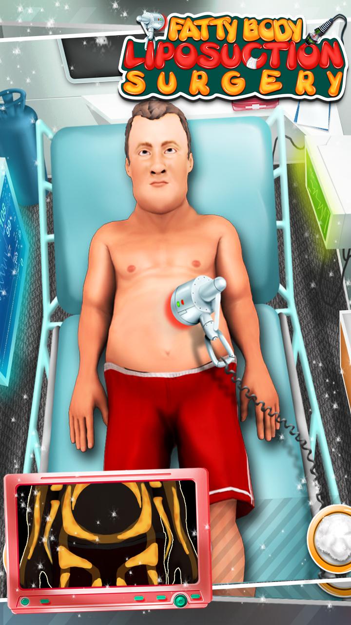 Fatty Body Liposuction Surgery