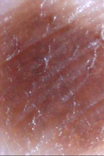 Skin Cancer Image Viewer