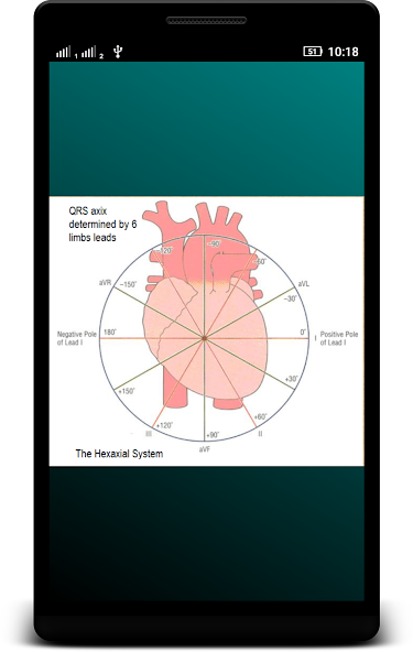 ECG Interpretation Basic