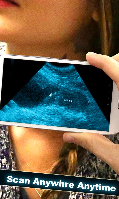 Baby Ultrasound Scanner :Prank